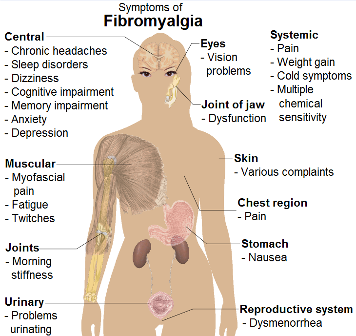 Symptoms_of_fibromyalgia