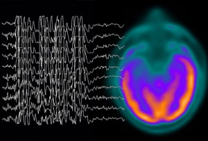 brain waves