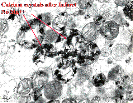 Mitochrondria