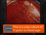 Helicobacter pylori culture