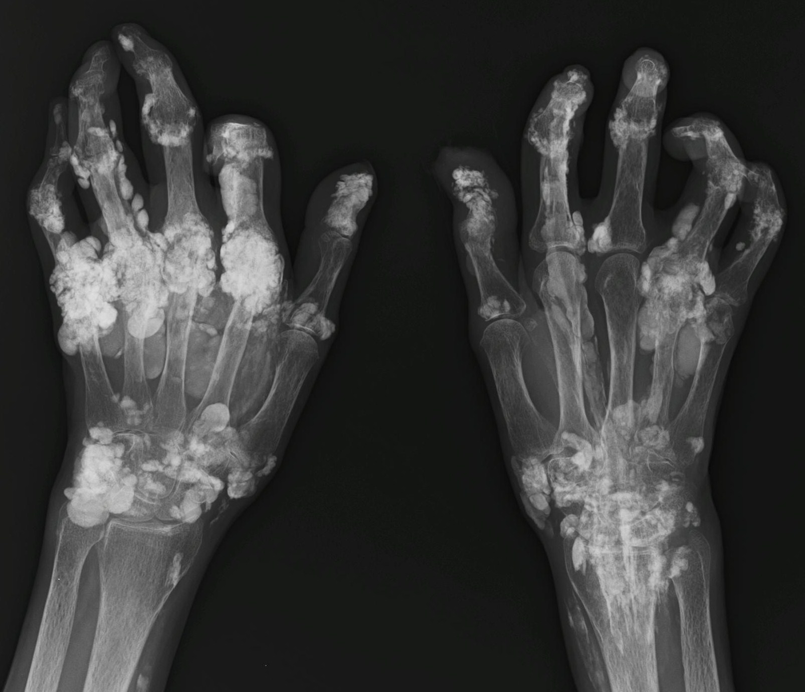 фото костей пальцев рук