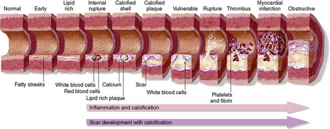 vitamin K2 benefits