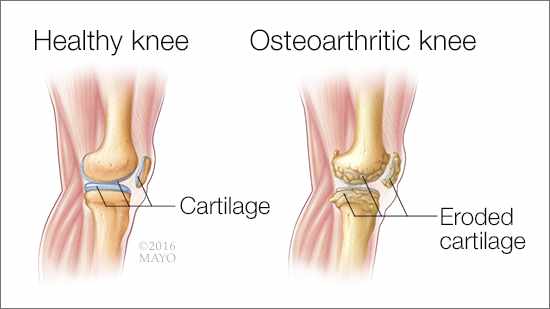 Why do my joints crack so much?