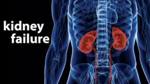 kidney failure